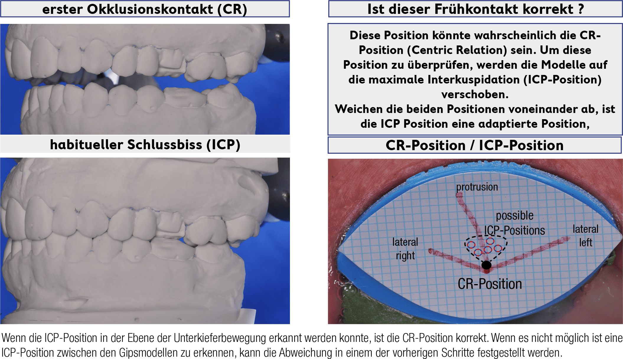 AFR-Mini-Reg  Komplettpaket