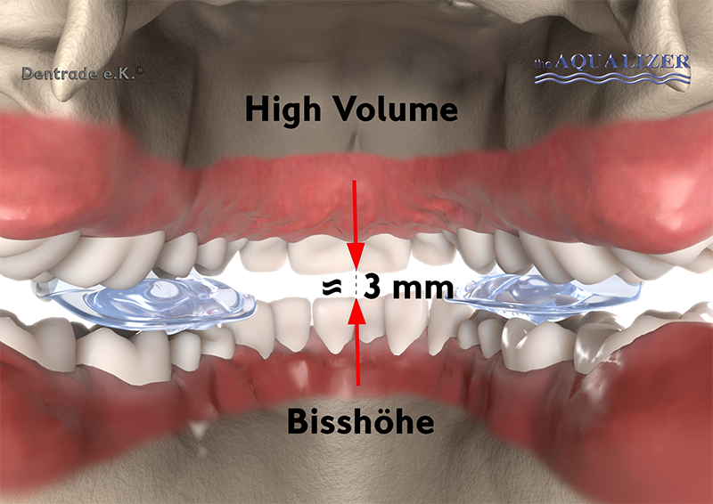 Aqualizer Soforthilfe bei CMD Beschwerden Dentrade